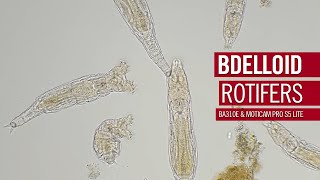 Bdelloid rotifers  An entire class of animals with no males  by Motic Europe [upl. by Jessica468]