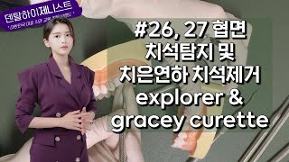 26 27 협면 치석탐지 및 치은연하치석제거 explorer gracey curette 치과위생사 실기시험 국가고시 [upl. by Hauhsoj780]