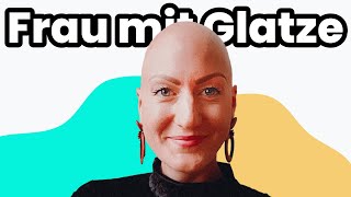 Frau mit Alopecia Glatze in der Pubertät [upl. by Ettenil]