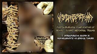 Visceroblastoma  Postquirurgical Complication Of Bowel MC FULL DEMO 2021  Goregrind [upl. by Boehike]