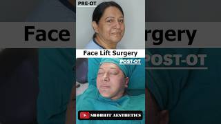 Face Left And double chin Liposuction Marking At Shobhit Aesthetic youtubeshorts [upl. by Salinas]