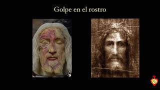 La Pasión de Cristo desde un punto de vista médico [upl. by Dub833]