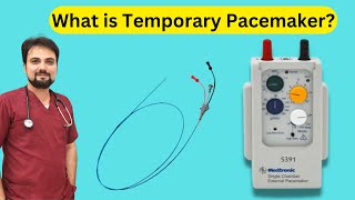 What is a Temporary Pacemaker [upl. by Anaxor]