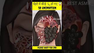 चेहरे में कीड़े 🐛हो गए 😱  there are insects on the face 3d animation  asmr youtube shorts [upl. by Oam]