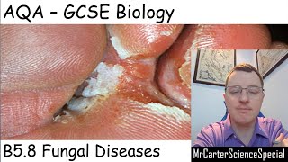 B58  Fungal Diseases  AQA Biology GCSE 91 [upl. by Gmur]