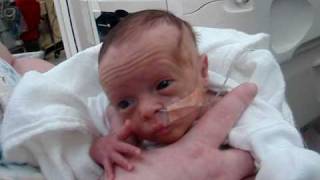 Lillians first bottle feeding and she hit 3 lbs NICU Premature baby [upl. by Adnaluoy]