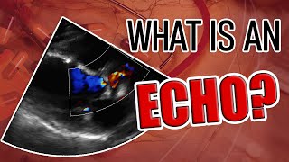 What is an Echocardiogram [upl. by Kajdan]