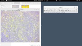 ImageJ Adding a Scale Bar to an Image [upl. by Itch]