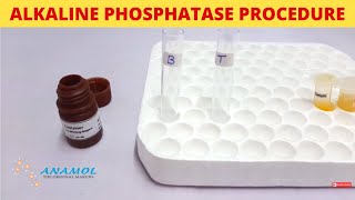 Alkaline Phosphatase Test  ALP Test [upl. by Lanam]