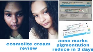 Cosmelite cream full review effect and side effects best for pigmentation [upl. by Ttsepmet]