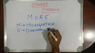 MEDICAL MNEMONIC POCKET EDWARD SYNDROME [upl. by Lowrance]