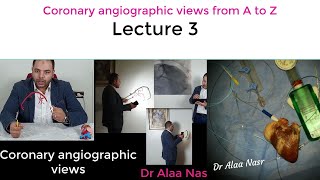 Coronary angiographic views 03 Dr Alaa Nasr Egypt 2020 [upl. by Hairym]