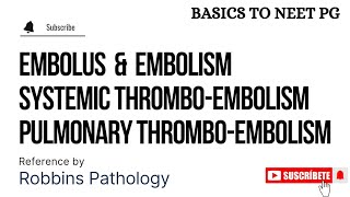 Embolus  Embolism  Part 1  Pulmonary ThromboEmbolism  Systemic ThromboEmbolism  KTC MBBS [upl. by Ecinehs]