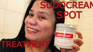 Get rid of spots acne and blemishes FAST Sudocream Face Mask [upl. by Harbed771]