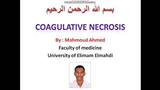 ٦ شرح ال coagulative necrosis محموداحمدSDLC [upl. by Drus572]