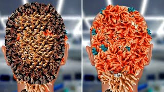 ASMR Removed Flying 😔 Bees Making Honey Comb on Head infection treatment Asmr animation bkasmr20 [upl. by Matilde]