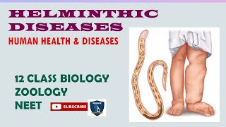 Helminthic Diseases  Human Health and Diseases I Zoology  Class 12  TNSCERTCBSE  NEET [upl. by Spalding]