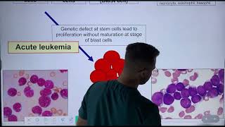 Lecture 1 p 2  WBC disorder  Hematopathology  طبالقادسية [upl. by Loftus]