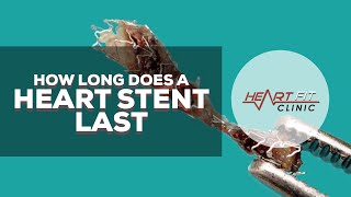 How long does a heart stent last [upl. by O'Dell]