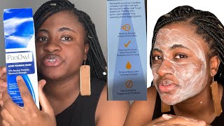 PANOXYL ACNE FOAMING WASH HONEST REVIEW  10 BENZOYL PEROXIDE [upl. by Itnavart]