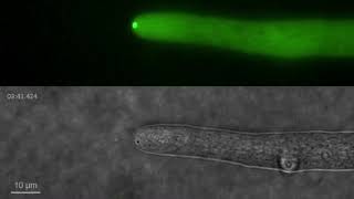 Spitzenkörper in filamentous fungus Neurospora crassa [upl. by Eciryt]