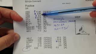 Hematology How to interpret automated Complete Blood Count CBC results [upl. by Ailuj]