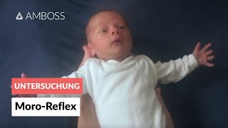 MoroReflex  Frühkindliche Reflexe  AMBOSS Video [upl. by Alta]