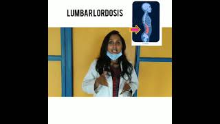 Exercises for Exaggerated Lumbar Lordosis [upl. by Luiza]