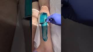 Professional lower leg wax using blue hard wax from Starpil hairremoval waxingexpert [upl. by Htevi]