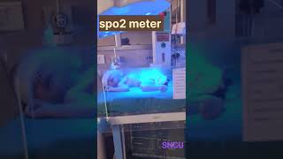 SNCU  neonatal care articles 🥰 short video 😍 trending reel [upl. by Suanne]