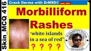 Morbilliform RASH  DENGUE  MEASLES  RUBELLA  HERPES ZOSTER  Viral Infections  MACULOPAPULAR [upl. by Adihaj]