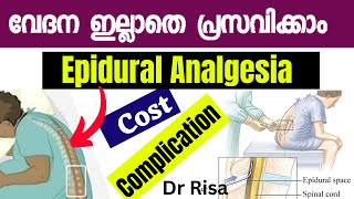 Epidural Analgesia  Painless Labor Malayalam deliverypain [upl. by Anauqcaj]