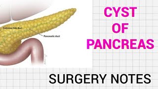 Cyst of pancreas in hindi  PSEUDOCYST AND TRUE CYST OF PANCREAS  SYMPTOMS AND TREATMENT [upl. by Torres]