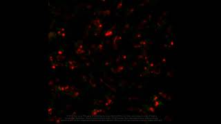 Injury to endothelial cells caused by CART123 – Supplementary video 4 ID 205678 [upl. by Nesnej]