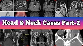 Radiology Viva Cases  376385  Head and Neck Exam Cases Part 2 medical radiology [upl. by Lasonde]