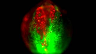 Convergent movement of wildtype donor cells in wildtype host zebrafish embryo [upl. by Jessabell]