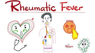 Rheumatic Fever  Jones Criteria  Causes Signs Symptoms Diagnosis amp Treatment  Cardiology [upl. by Ramsay]