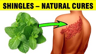 How To Treat Shingles Naturally  Homemade Remedies [upl. by Wildermuth860]