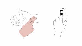 Mastering transcutaneous pacing [upl. by Krasnoff]