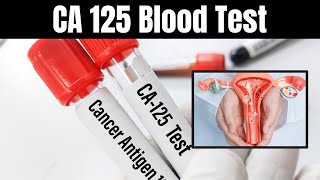 CA 125 Blood Test Explained Uses Procedures and What It Means for You [upl. by Trebo]