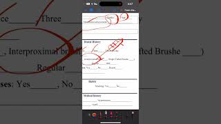 Case sheet Periodontics 5th stage part1 [upl. by Notrab575]