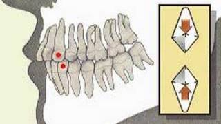 How the Body Works  The Permanent Teeth [upl. by Eldon]