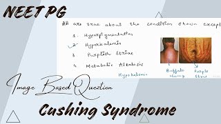 Cushing Syndrome  Image based questions  for NEET PG [upl. by Notgnilliw559]