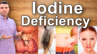 8 Symptoms of Iodine Deficiency  Hair Loss Weight Gain Constipation Feeling Tired and a Dry Skin [upl. by Schultz]