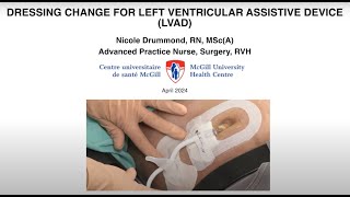 DRESSING CHANGE FOR LEFT VENTRICULAR ASSISTIVE DEVICE LVAD [upl. by Tamera]