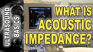 ultrasound and acoustic impedance explained [upl. by Etteve]