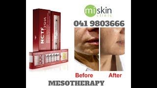 Filorga NCTF Mesotherapy [upl. by Adnana777]