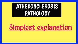 Atherosclerosis  Pathophysiology [upl. by Codi444]