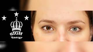 Heterochromia Treatment EXTREMELY POWERFULEnergetically Programmed [upl. by Gabriele]