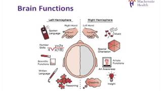 Stroke Education  Causes and Effects [upl. by Klenk710]